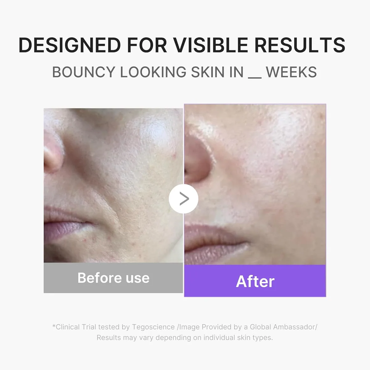 Medicube Mini Booster Pro Plus Full Facial Device Set